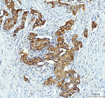 Anti-XTP3TPA/DCTPP1 Antibody