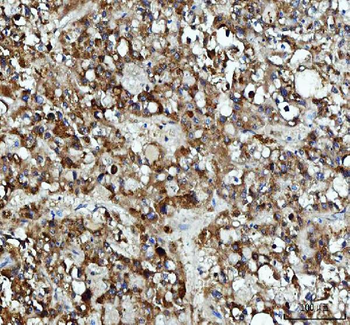 Anti-XTP3TPA/DCTPP1 Antibody