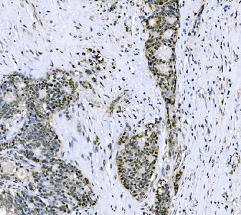Anti-CSNK2B Antibody