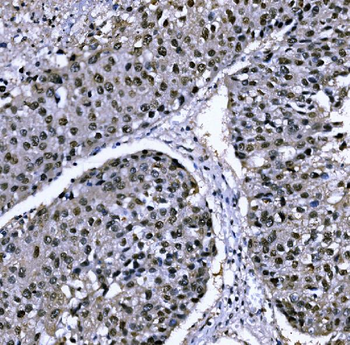 Anti-CSNK2B Antibody
