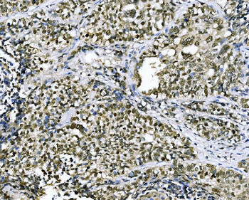 Anti-CSNK2B Antibody