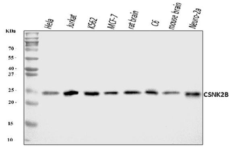 Anti-CSNK2B Antibody
