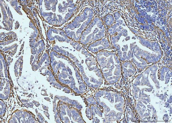 Anti-Collagen VI/COL6A2 Antibody