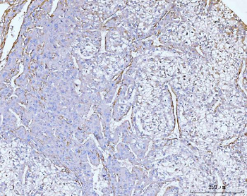 Anti-Collagen VI/COL6A2 Antibody