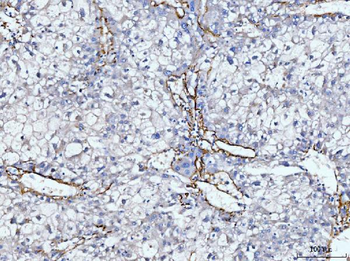 Anti-Collagen VI/COL6A2 Antibody