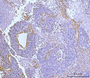 Anti-Collagen VI/COL6A2 Antibody