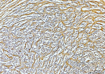 Anti-Collagen VI/COL6A2 Antibody