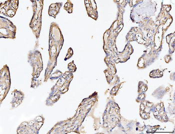 Anti-Collagen VI/COL6A2 Antibody