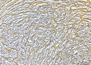 Collagen VI/COL6A2 Antibody