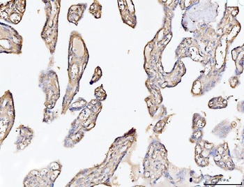 Collagen VI/COL6A2 Antibody