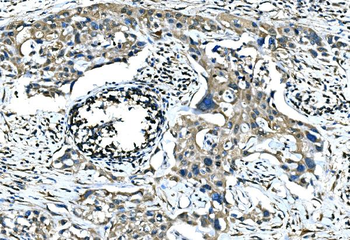 Anti-Calponin 2/CNN2 Antibody