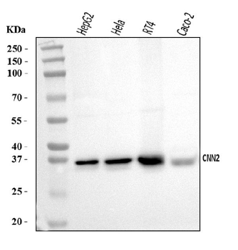 Anti-Calponin 2/CNN2 Antibody