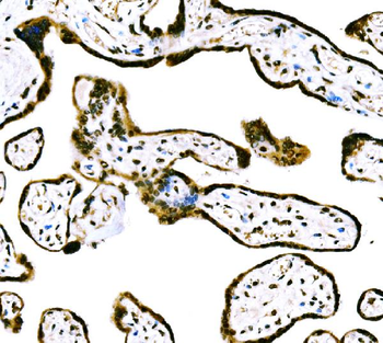 Anti-CBX2 Antibody