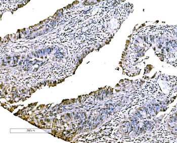 Anti-CBX2 Antibody