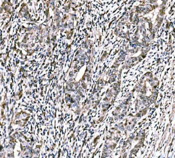 Anti-CBX2 Antibody
