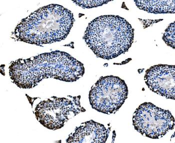 Anti-CBX2 Antibody