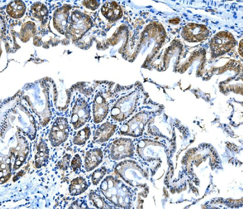 Anti-Btc Antibody