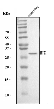 Anti-Btc Antibody