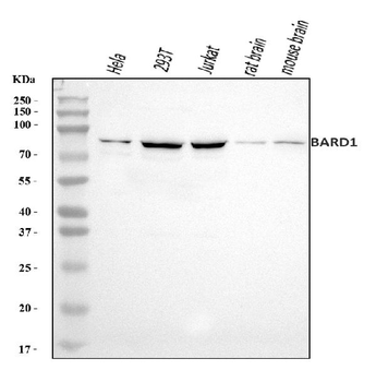 Anti-BARD1 Antibody