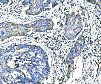 Anti-ATG16L1 Antibody
