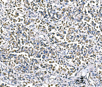 Anti-ATG16L1 Antibody