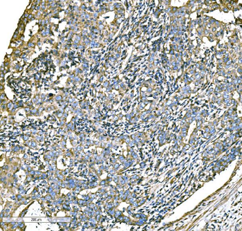 Anti-ATG16L1 Antibody