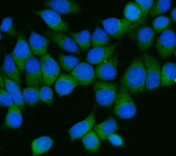Anti-AP2M1 Antibody