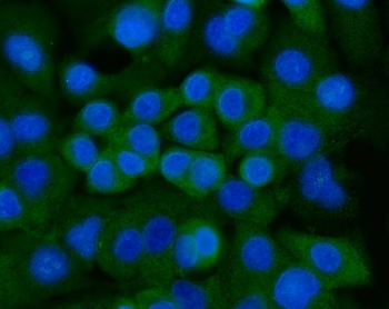 Anti-Ankyrin erythroid/ANK/ANK1 Antibody