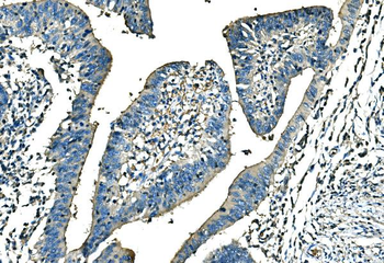 Anti-Ankyrin erythroid/ANK/ANK1 Antibody