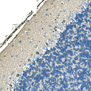 Anti-Ankyrin erythroid/ANK/ANK1 Antibody