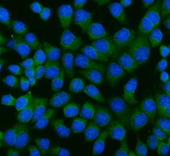 Anti-RAGE/AGER Antibody