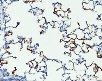 Anti-RAGE/AGER Antibody