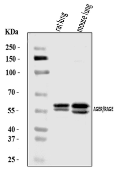 Anti-RAGE/AGER Antibody