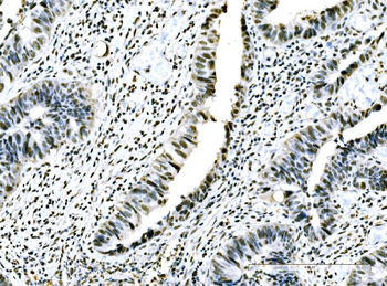 Anti-ADAR1/ADAR Antibody