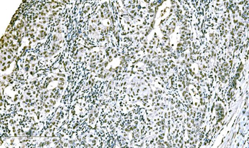Anti-ADAR1/ADAR Antibody