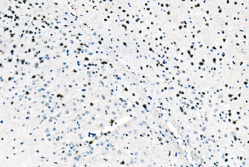 Anti-ADAR1/ADAR Antibody