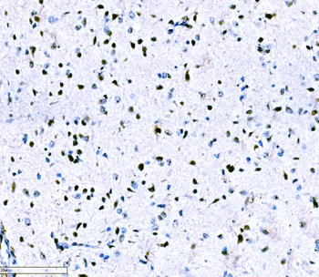 Anti-ADAR1/ADAR Antibody