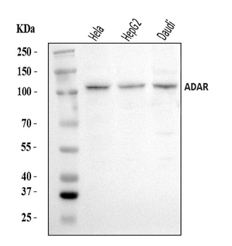 Anti-ADAR1/ADAR Antibody