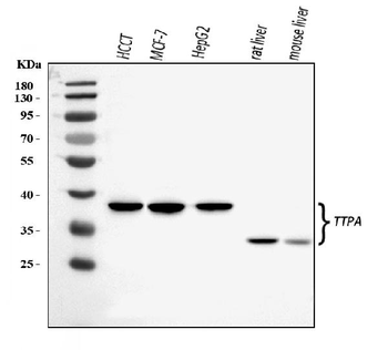 Anti-TTPA/TPP1 Antibody