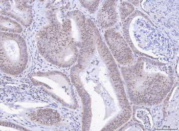 Anti-TOX Antibody