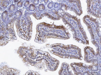 Anti-TOX Antibody