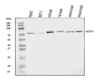Anti-Solo/SESTD1 Antibody