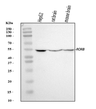 Anti-ROR beta/RORB Antibody