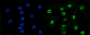 Anti-RAD50 Antibody