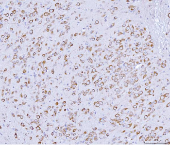 Anti-PRKRA Antibody
