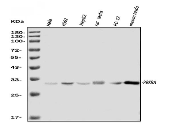Anti-PRKRA Antibody