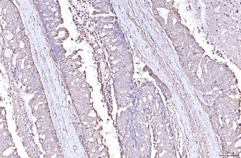 Anti-PLP2 Antibody