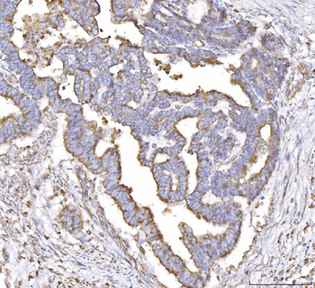 Anti-PLP2 Antibody