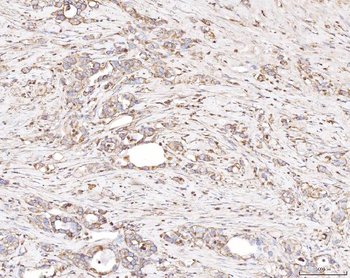 Anti-PLP2 Antibody