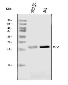 Anti-PLP2 Antibody